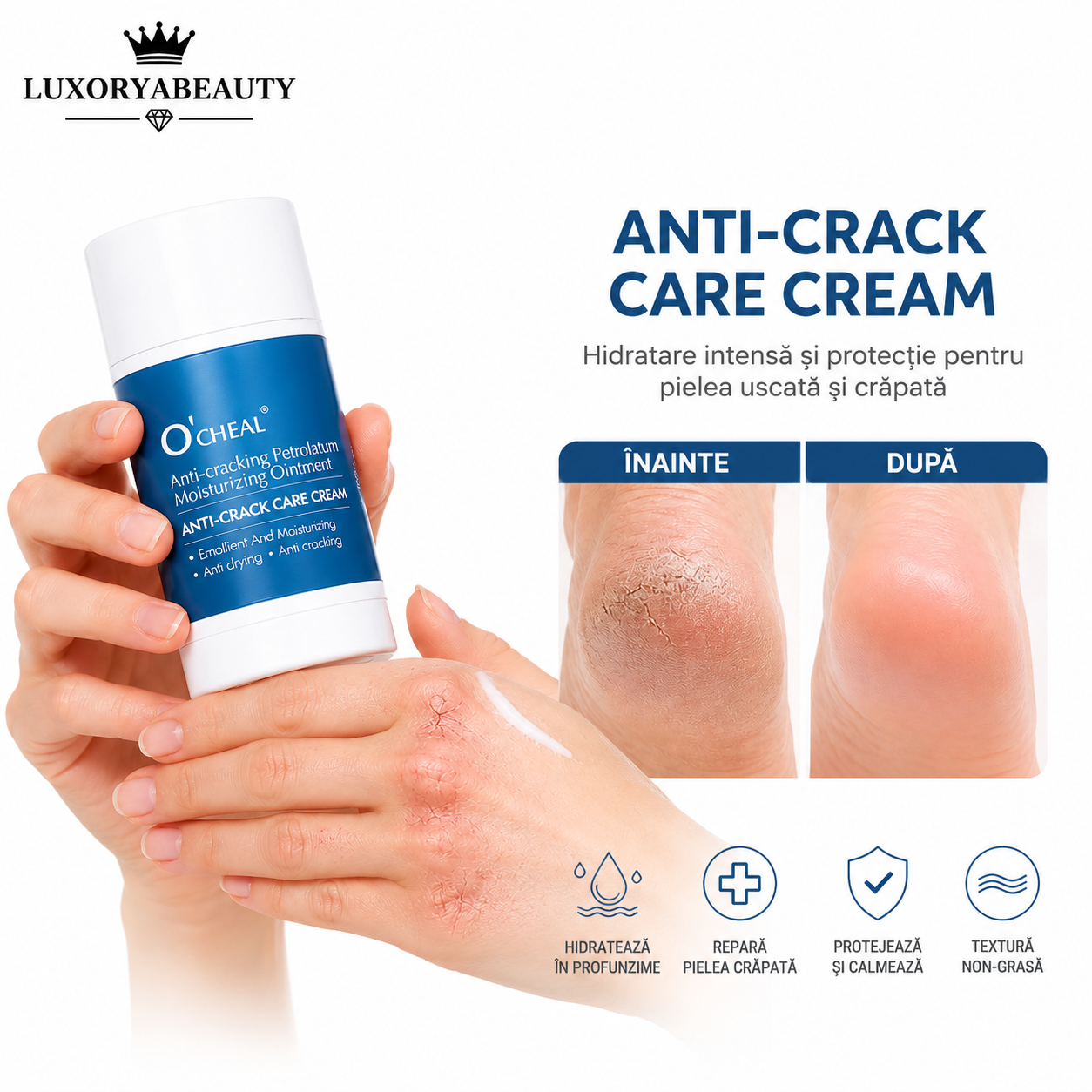 Set 2 Creme Ocheal Anti-Crack pentru Piele Uscată și Crăpată – Hidratare Intensă, Reparare și Protecție pentru Mâini, Călcâie, Coate și Genunchi